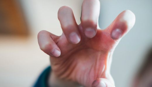 爪をむしる癖・いじる癖の原因や心理 | 確実に直す治療法や改善方法